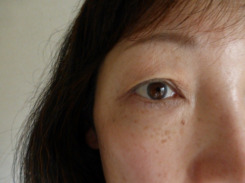 ほうれい線･上瞼の改善アップ